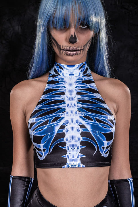 X-Ray Skeleton Fit Top